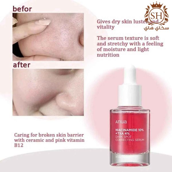 ⁦سيروم أنوا الأحمر نياسيناميد 10% ANUA Niacinamide Serum⁩ - الصورة ⁦3⁩