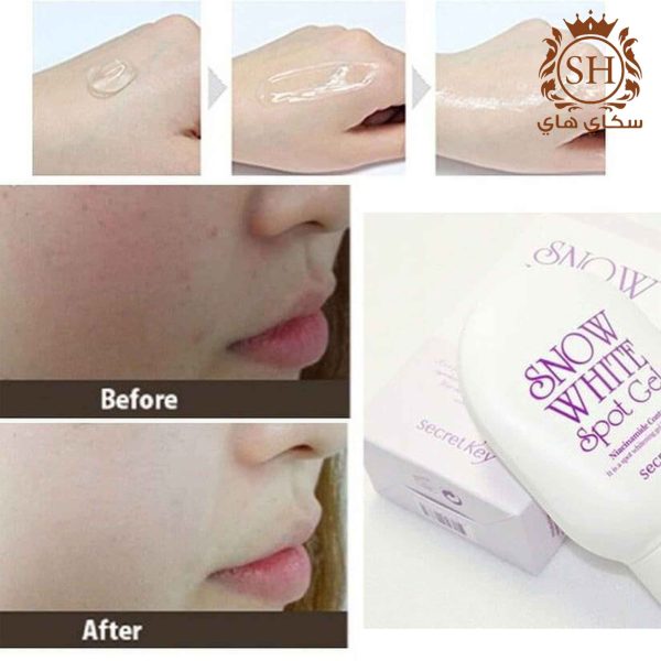 ⁦جل سنو وايت للتبييض - Snow White Whitening Gel⁩ - الصورة ⁦2⁩